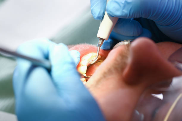 Best Emergency Tooth Extraction in Newell, WV