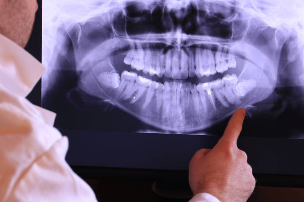 Best Emergency Dental Care for Broken or Chipped Teeth in Newell, WV